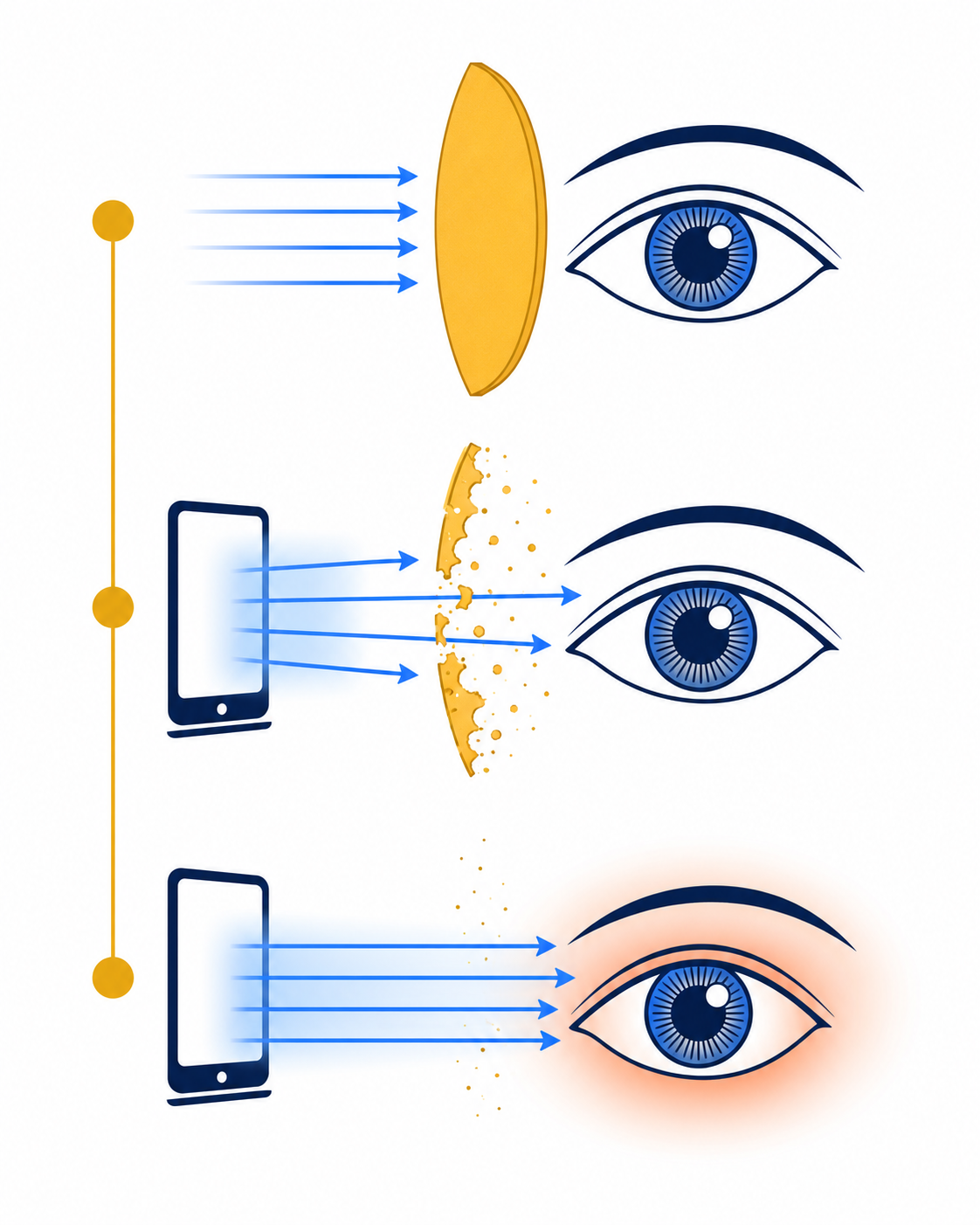 Three-stage diagram: healthy macular pigment filtering blue light; pigment depleting under daily screen exposure; oxidative damage reaching the retina once the filter is worn down.